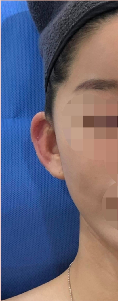 After